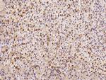 Calcineurin A Polyclonal Antibody