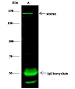ROCK1 Polyclonal Antibody