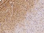 ECD Antibody in Immunohistochemistry (Paraffin) (IHC (P))