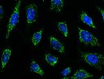SMAD9 Polyclonal Antibody