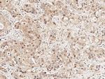 SMG1 Antibody in Immunohistochemistry (Paraffin) (IHC (P))
