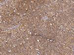 SMG1 Antibody in Immunohistochemistry (Paraffin) (IHC (P))