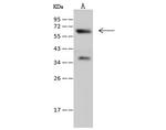 Synaptotagmin 1 Polyclonal Antibody