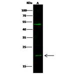 UBE2M Polyclonal Antibody