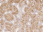 ACE Polyclonal Antibody