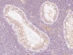 ANGEL1 Antibody in Immunohistochemistry (Paraffin) (IHC (P))