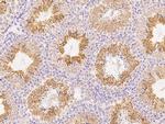 ANGEL1 Polyclonal Antibody