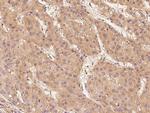 c-Raf Antibody in Immunohistochemistry (Paraffin) (IHC (P))