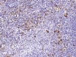 CD160 Polyclonal Antibody