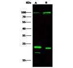 P-Selectin Antibody in Western Blot (WB)