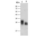 Adenylate Kinase 1 Polyclonal Antibody