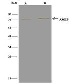 alpha-1 Microglobulin Antibody in Immunoprecipitation (IP)