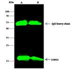 COPZ1 Antibody in Immunoprecipitation (IP)