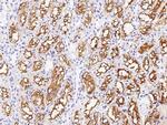 GGT1 Polyclonal Antibody