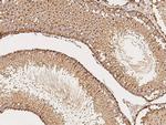 NPC2 Polyclonal Antibody