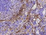 Thrombomodulin Polyclonal Antibody