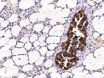 WFDC2 Antibody in Immunohistochemistry (Paraffin) (IHC (P))