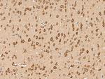 uPAR Antibody in Immunohistochemistry (Paraffin) (IHC (P))