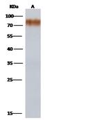 Influenza A H1N1 HA (A/Brevig Mission/1/1918) Polyclonal Antibody