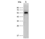 Influenza A NP Polyclonal Antibody