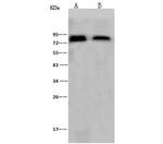 Influenza A H1N1 HA (A/Puerto Rico/8/34) Polyclonal Antibody