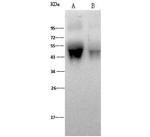 Influenza A H1N1 HA1 (A/WSN/33) Polyclonal Antibody