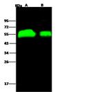 Influenza H4N6 HA1 (A/Swine/Ontario/01911-1/99) Polyclonal Antibody