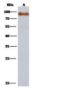Influenza A H15N8 HA (A/duck/AUS/341/1983) Polyclonal Antibody