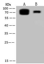 Influenza B NP (B/Florida/4/2006) Polyclonal Antibody