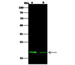 Ebola Virus NP (strain New Guinea 2014) Polyclonal Antibody