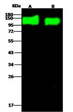 HIV1 gp120 Polyclonal Antibody