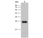 HIV1 p24 (group M, subtype B, strain 92418) Polyclonal Antibody