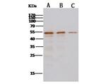 MERS Coronavirus NP Antibody in Western Blot (WB)