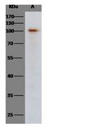 SARS Coronavirus Spike Protein (subunit 1) Antibody in Western Blot (WB)