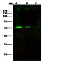 HIV p51 (group M, subtype B (isolate HXB2)) Polyclonal Antibody