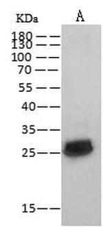 HIV1 p24 (group N, strain 06CM-U14296) Polyclonal Antibody