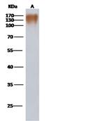HIV1 gp120 (group P, strain RBF168) Polyclonal Antibody