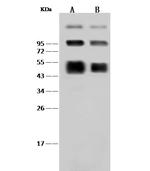 Dengue Virus Type 2 NS1 (strain New Guinea C) Polyclonal Antibody