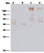 Ebola Virus GP (subtype Zaire, strain Mayinga 1976) Polyclonal Antibody