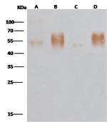 Ebola Virus GP-RBD (subtype Zaire, strain Mayinga 1976) Antibody in Western Blot (WB)