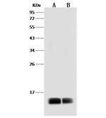 Dengue Virus Type 2 Envelope (strain New Guinea C/PUO-218 hybrid) Polyclonal Antibody