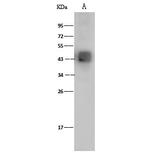 Dengue Virus Type 2 Envelope (strain New Guinea C/PUO-218 hybrid) Polyclonal Antibody