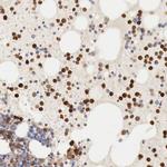 G6PD Antibody in Immunohistochemistry (Paraffin) (IHC (P))