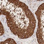 G6PD Antibody in Immunohistochemistry (Paraffin) (IHC (P))