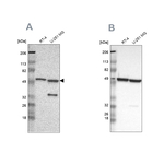 G6PD Antibody in Western Blot (WB)