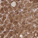 Radixin Antibody in Immunohistochemistry (Paraffin) (IHC (P))