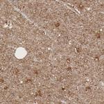 Radixin Antibody in Immunohistochemistry (Paraffin) (IHC (P))