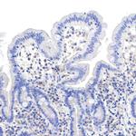 Radixin Antibody in Immunohistochemistry (Paraffin) (IHC (P))