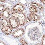 Radixin Antibody in Immunohistochemistry (Paraffin) (IHC (P))