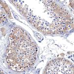 Radixin Polyclonal Antibody